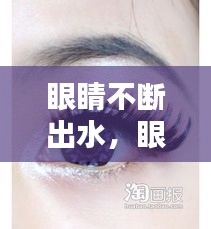眼睛不斷出水，眼睛一直出水的是什么情況 