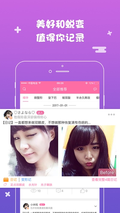 米團(tuán)網(wǎng)官方下載,動態(tài)說明分析-特別款_v8.527